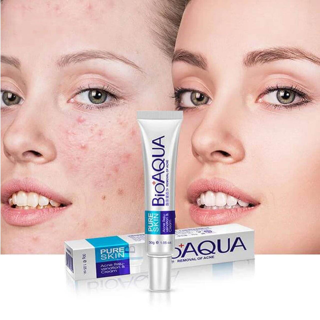 BIOAQUA Anti-Acne & Rejuvenating Cream - Acne Care 30g