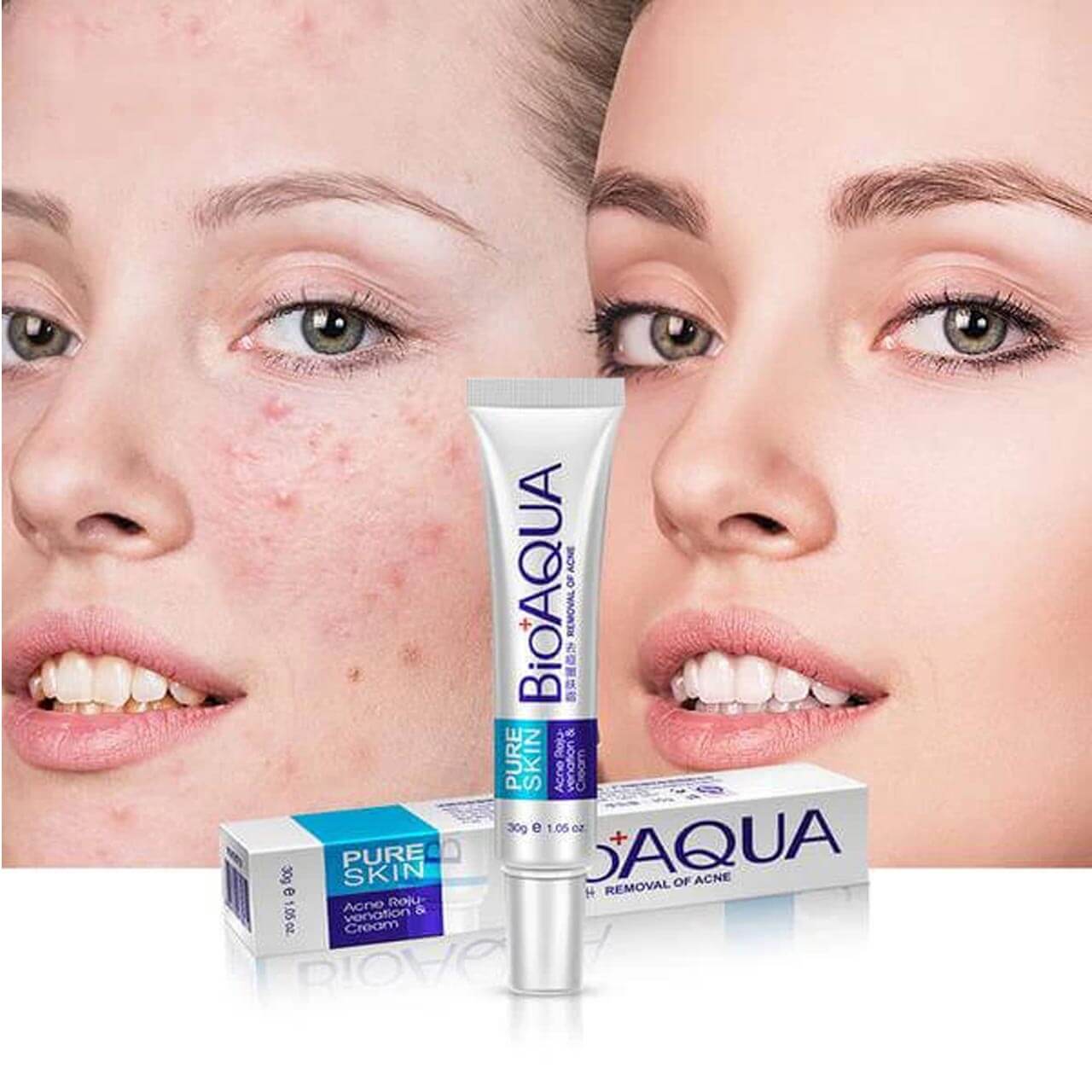 BIOAQUA Anti-Acne & Rejuvenating Cream - Acne Care 30g